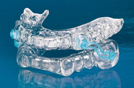Photo of a Silent Night appliance, which helps with sleep apnea and snoring - available from Kentucky Dental Group of Lexginton.
